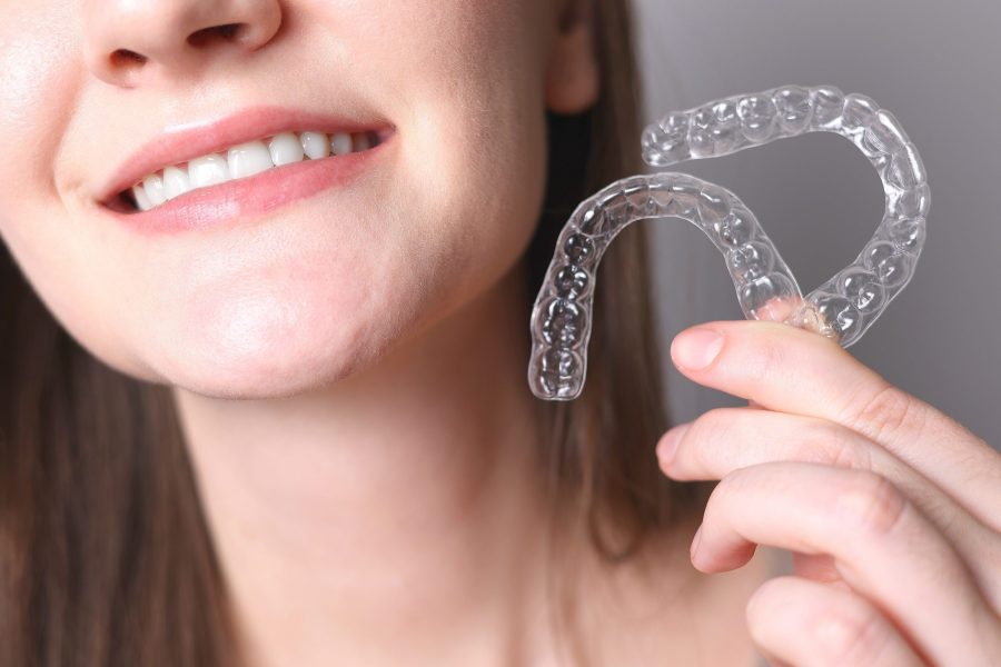 Clear Aligners in Sunnyvale