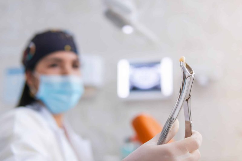 Tooth Extractions in Sunnyvale