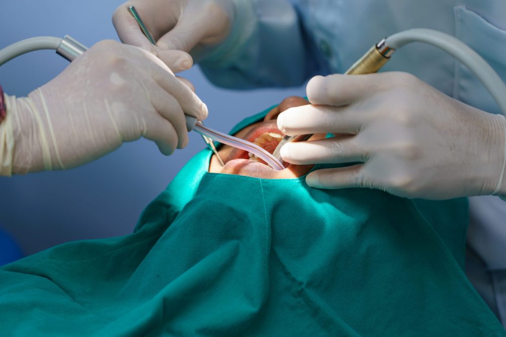 oral surgery Sunnyvale